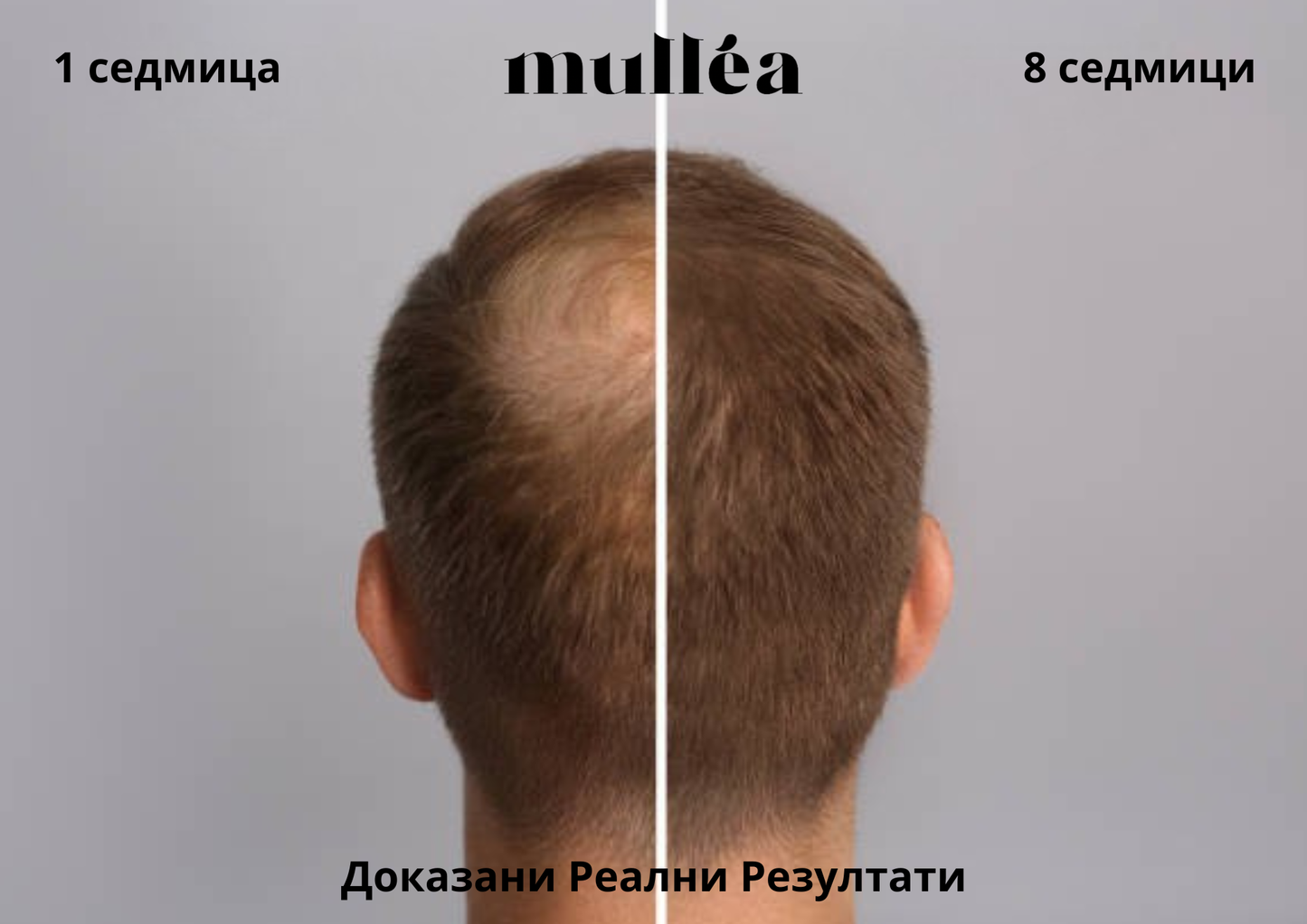 Mullèa Hair Growth Serum