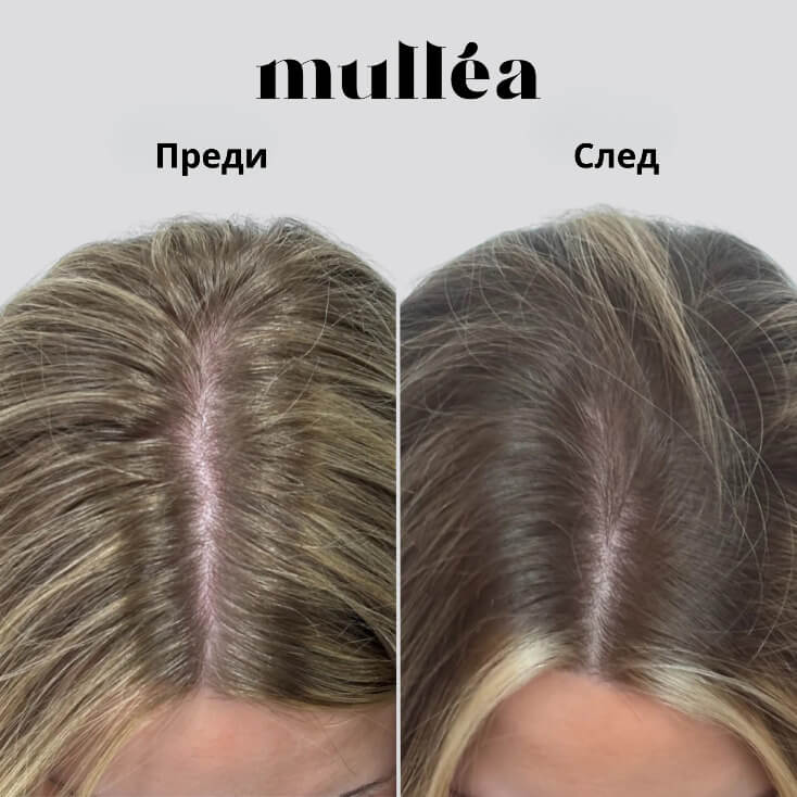 Mullèa Hair Growth Serum