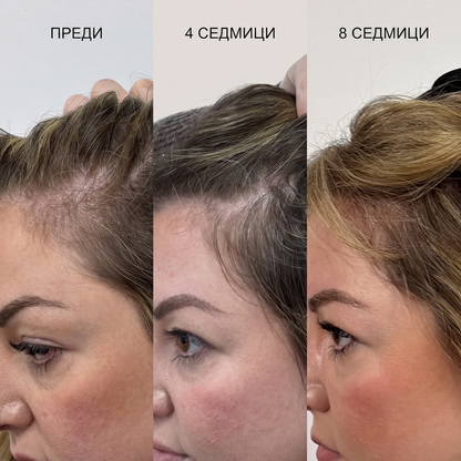 Mullèa                                                     Hair Growth Serum