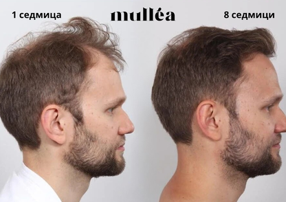 Mullèa                                                     Hair Growth Serum
