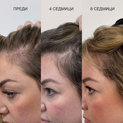 Mullèa                                                     Hair Growth Serum