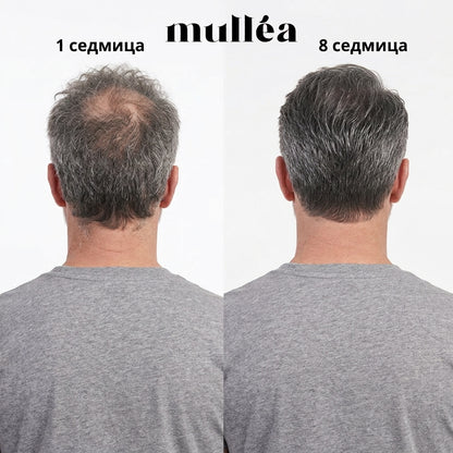 Mullèa                                                     Hair Growth Serum