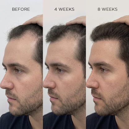 Mullèa                                                     Hair Growth Serum