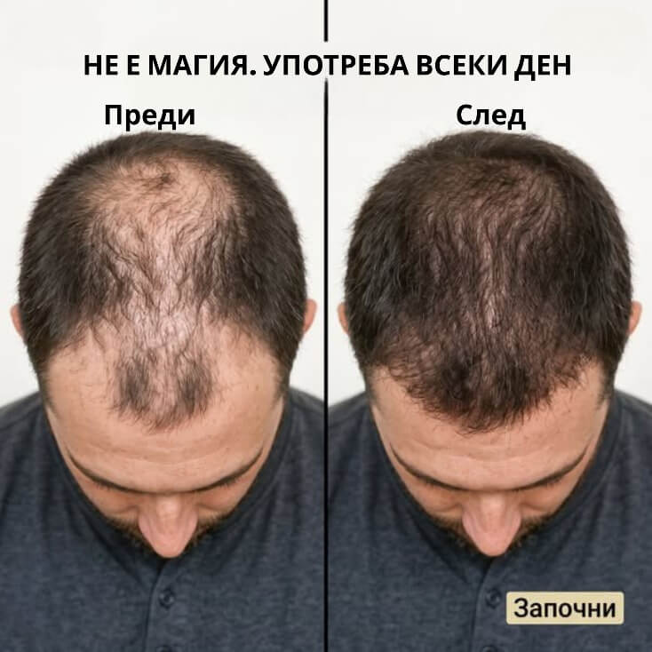 Mullèa                                                     Hair Growth Serum