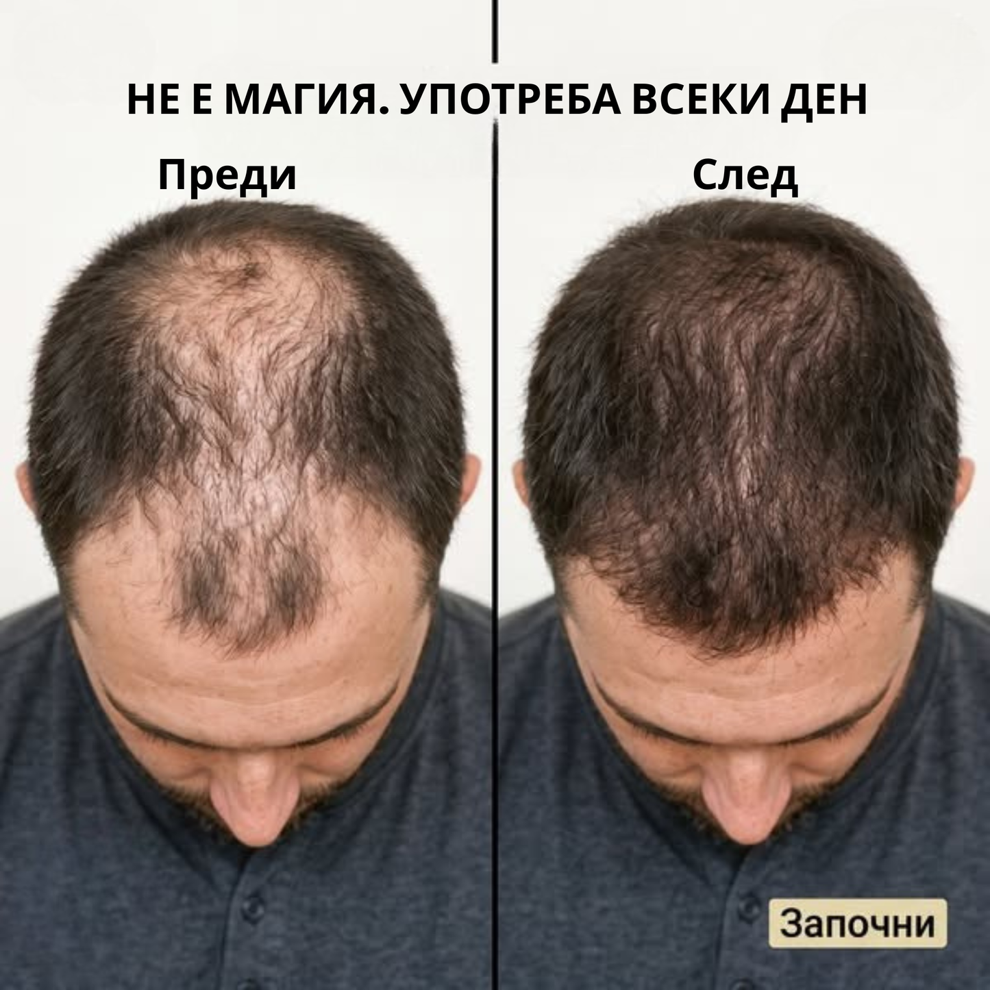 Mullèa                                                     Hair Growth Serum